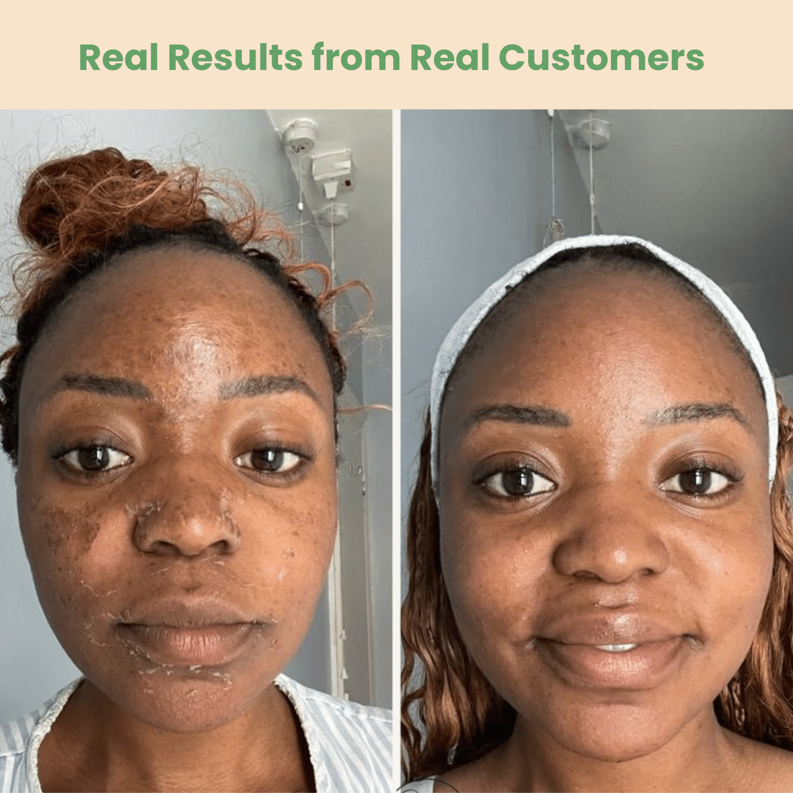 dark spot serum